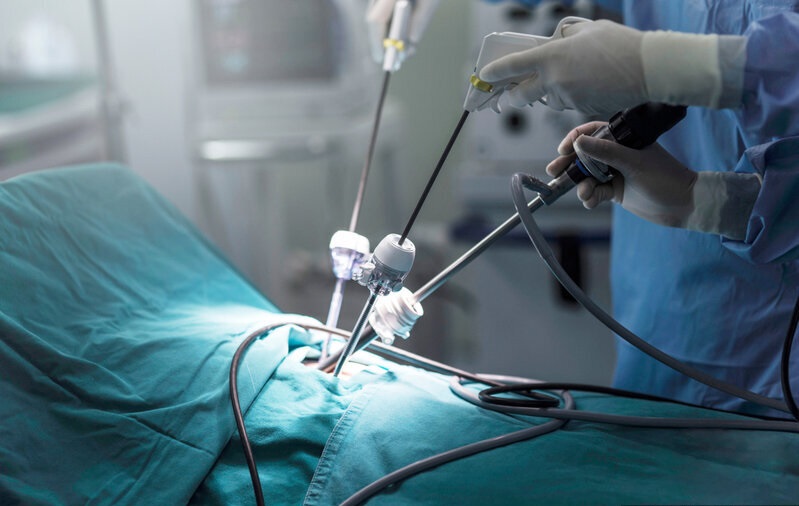 Преимущество лапароскопических операций