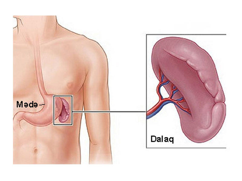 Dalaq